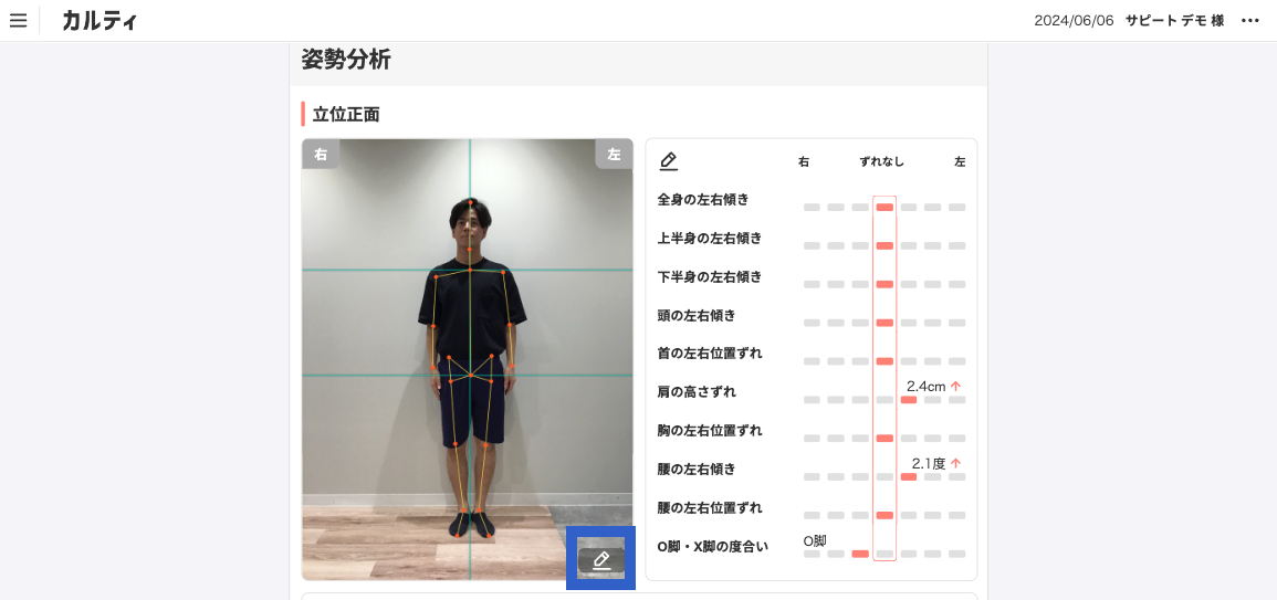 分析結果_姿勢写真の編集アイコン.png