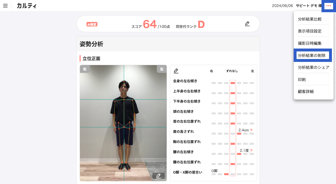分析結果画面_姿勢分析_分析結果の削除.png