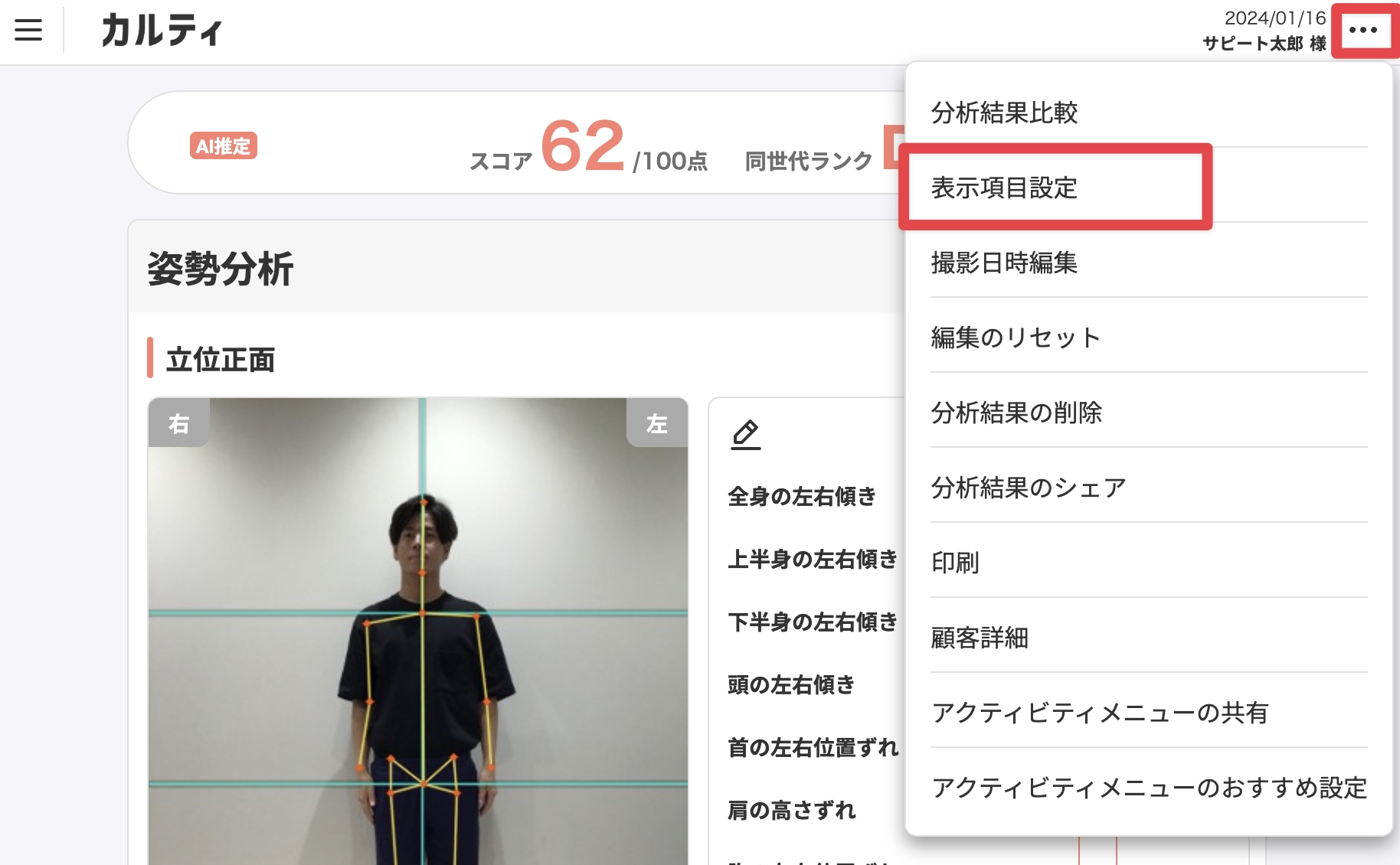 表示項目設定の場所_シセイカルテ結果画面.png